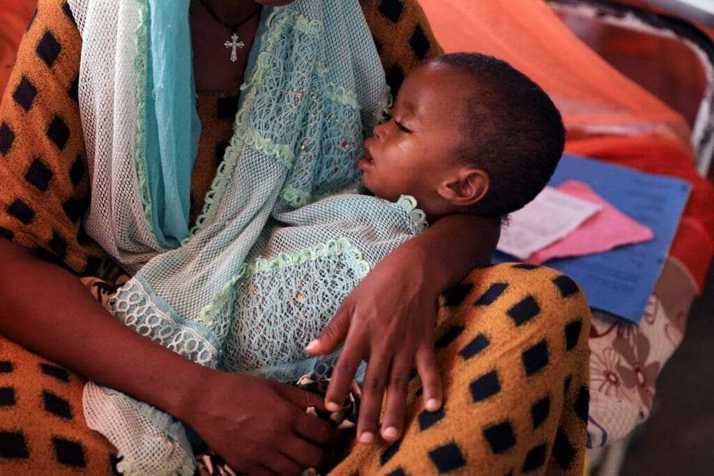 A malnourished child is held by his mother at a camp for people displaced by drought in Gode, Ethiopia.